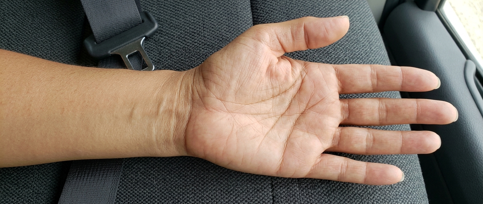 Chained head line crossing a non-dominant palm at rest: the non-dominant hand shows innate potential and character